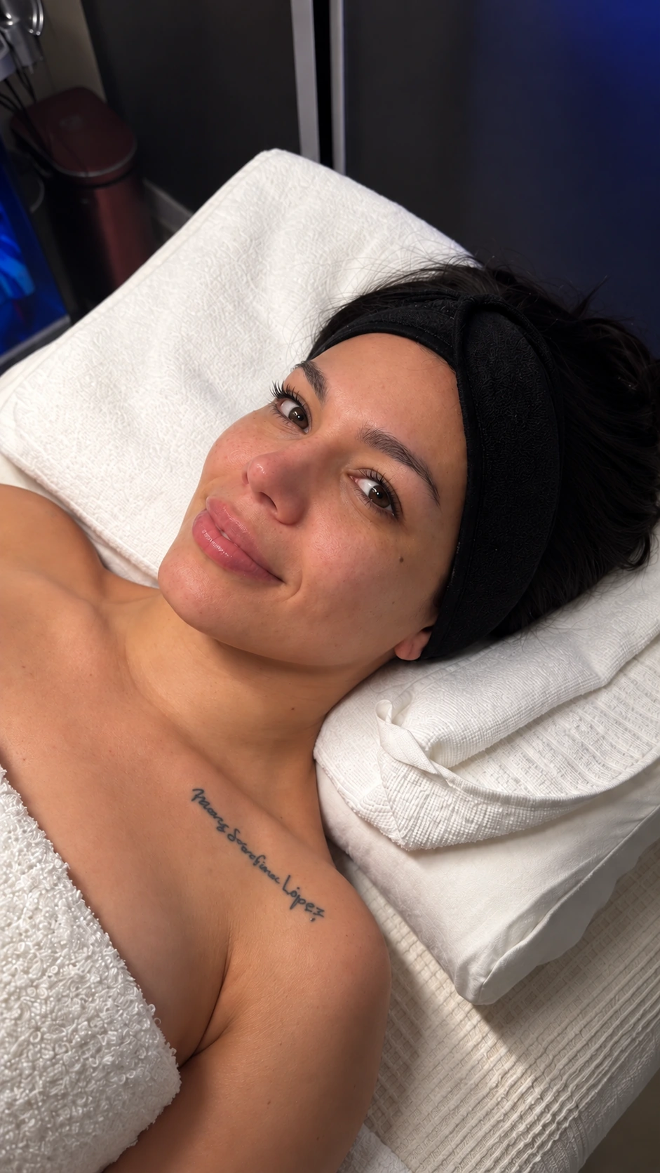 Mónica: fotografía antes aportada para el comparativo Hydrafacial