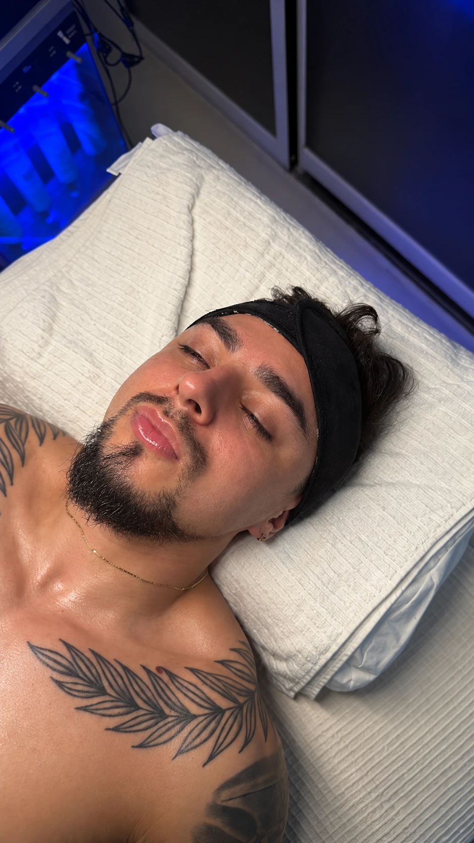 Andrés: fotografía después aportada para el comparativo Hydrafacial