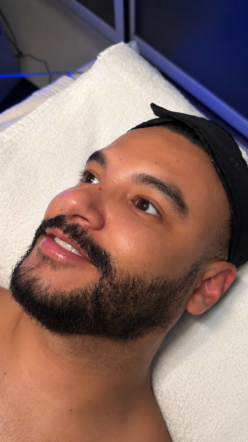 Jorge: fotografía después aportada para el comparativo Hydrafacial